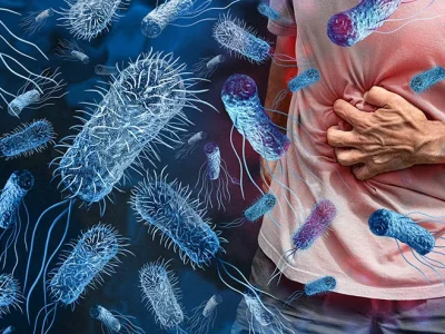 Food Poisoning Treatment in Jaipur | SND Multispeciality Hospital
